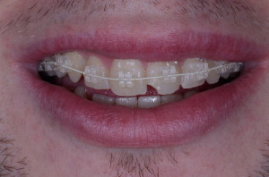 maxilofacial ortodoncia