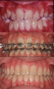 Riesgos de la cirugía maxilofacial