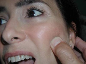 causas del dolor facial